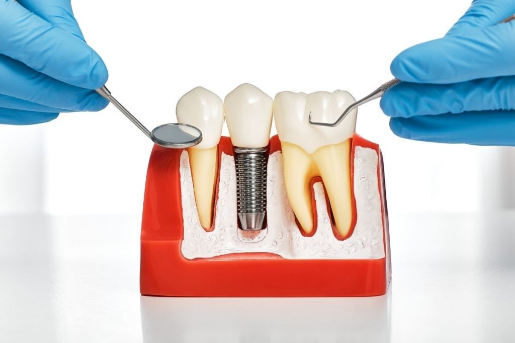 dental health